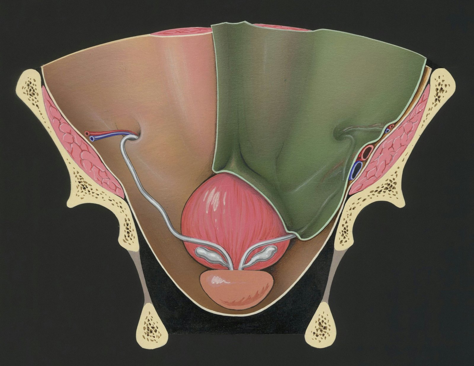 How to fix venous leak with diagnosis and treatment information