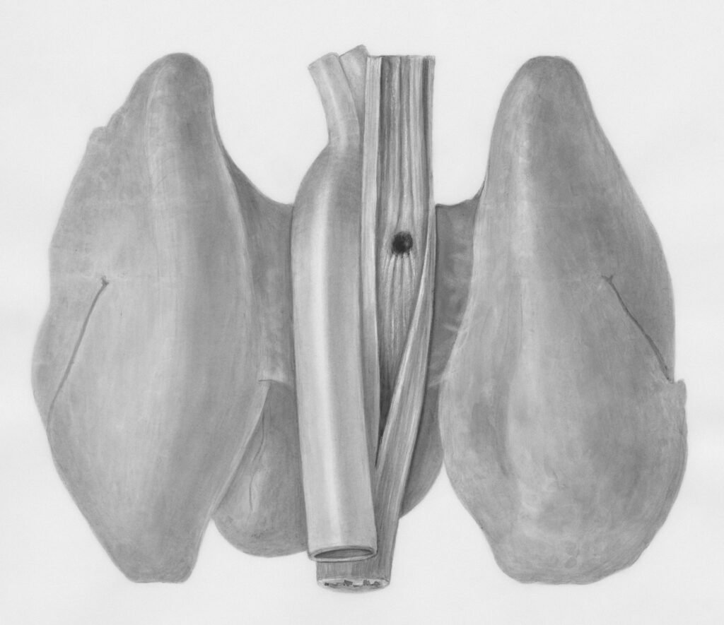 Why is my hip replacement hurting after 5 years and what may cause pain