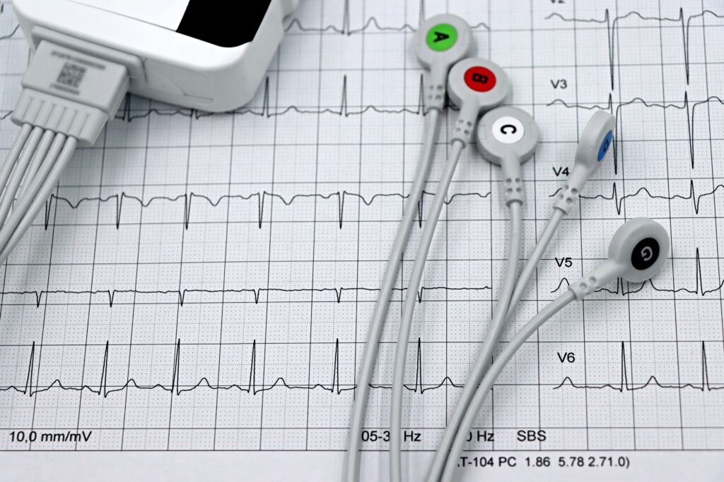 ECG showing a nonspecific T wave abnormality and its possible meaning